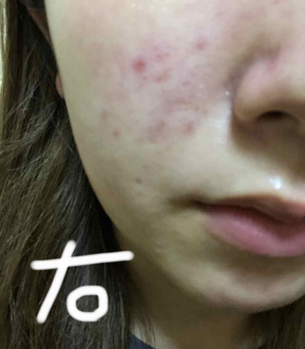 CICA クリーム/VT/フェイスクリームを使ったクチコミ(3枚目)