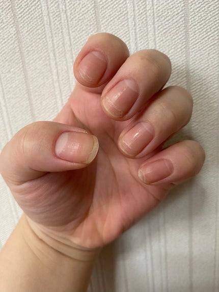 ネイルサポート Na/ネイルネイル/ネイルトップコートを使ったクチコミ(1枚目)