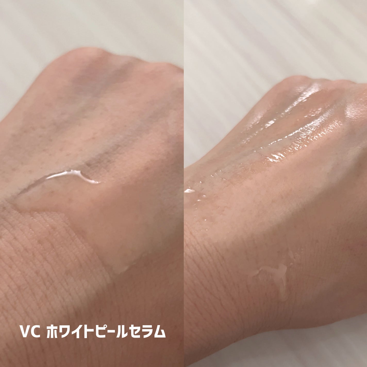 SKIOトライアルキット/SKIO/トライアルキットを使ったクチコミ(2枚目)