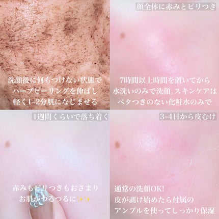 ダーマスキンピーリング/BQCELL/その他キットセットを使ったクチコミ(2枚目)
