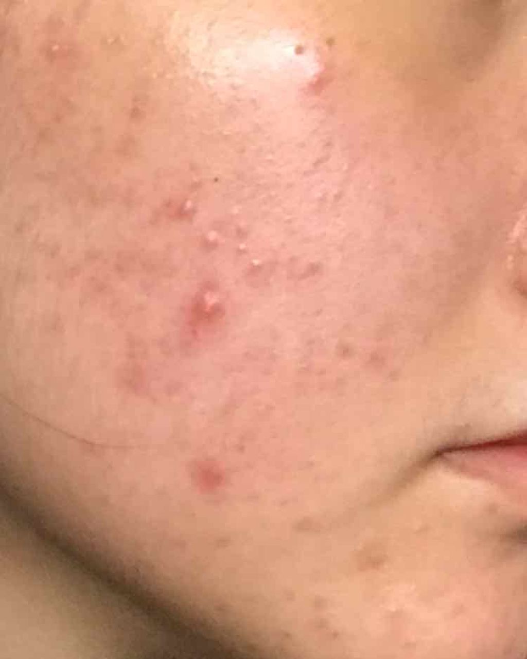 薬用 クリアローション M(しっとりタイプ)/オルビス/化粧水を使ったクチコミ(2枚目)