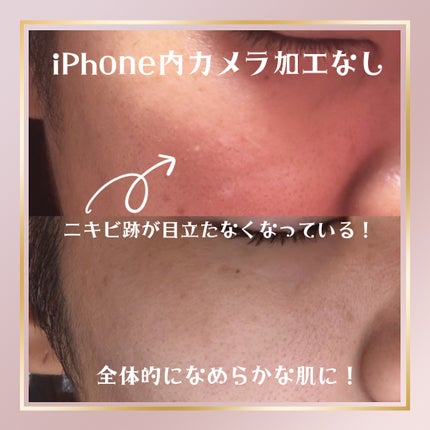 フェイスクリーム/ル・マイルド/フェイスクリームを使ったクチコミ(1枚目)