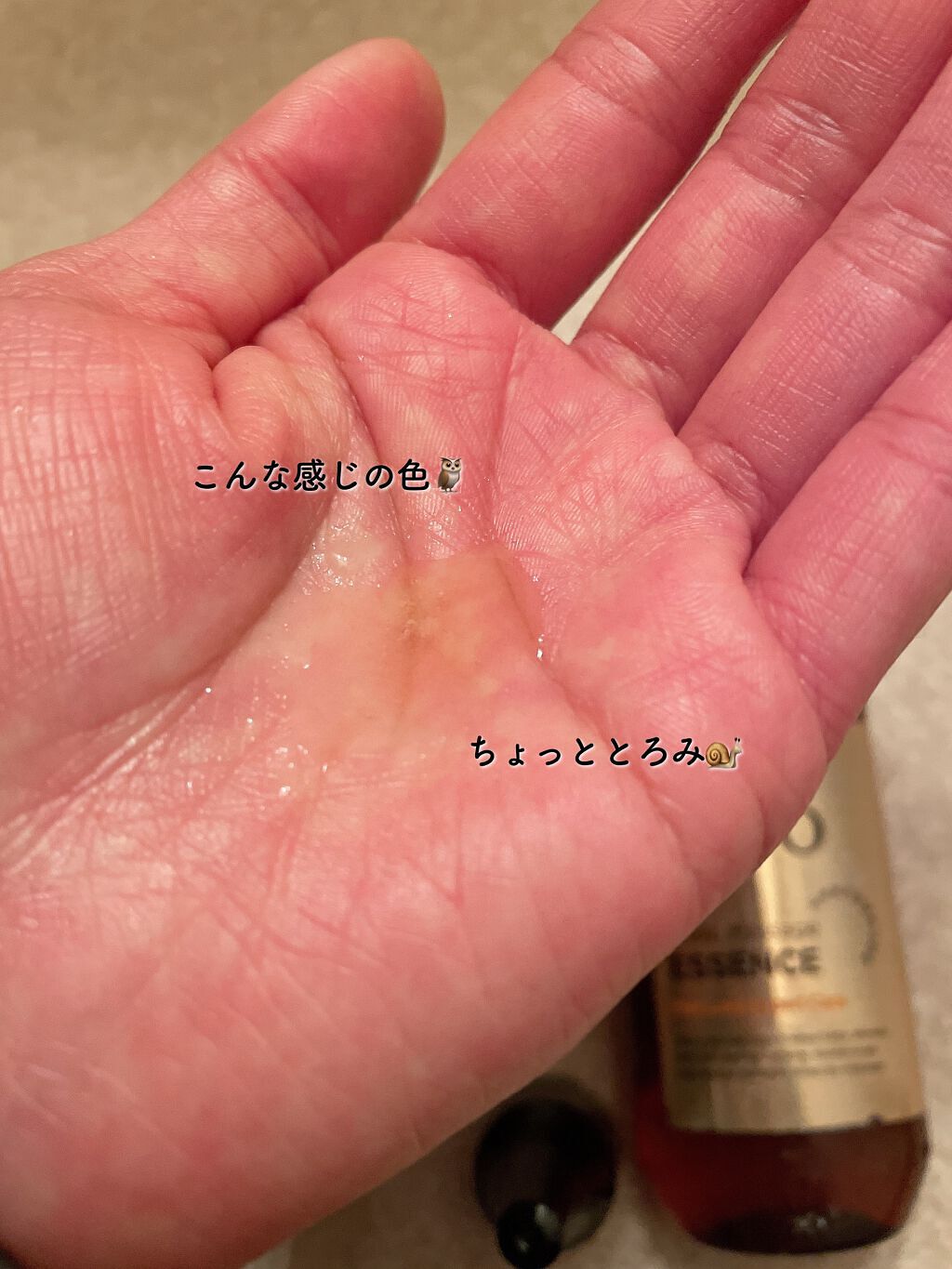 毛根栄養津液エッセンス /呂/頭皮ローションを使ったクチコミ（3枚目）