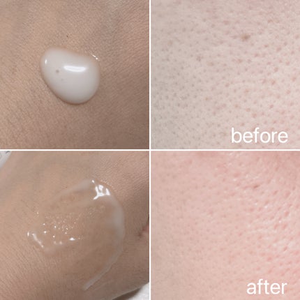 ダイヤリフト3000ショット/ECLIMOI/フェイスクリームを使ったクチコミ(4枚目)