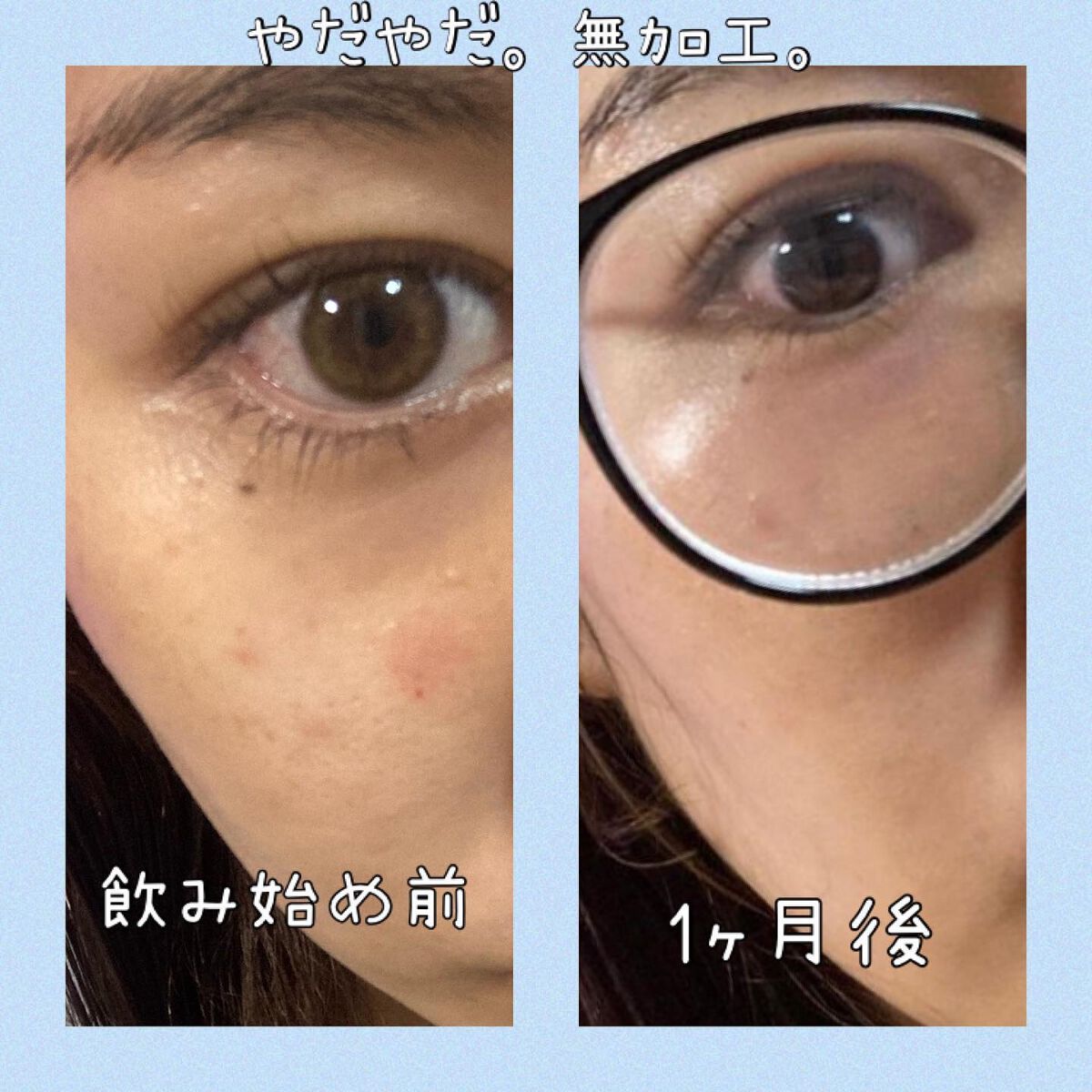 スノーセル/メディタミン/美容サプリメントを使ったクチコミ(4枚目)