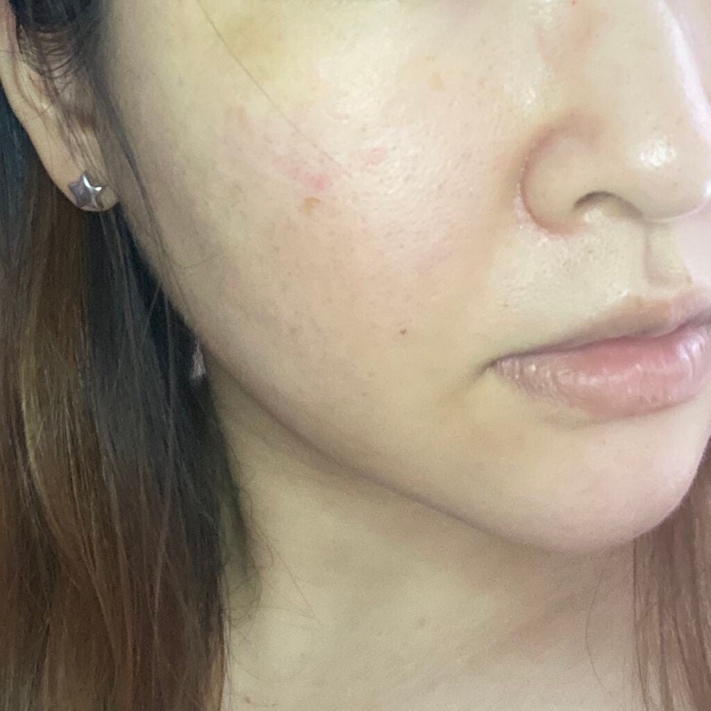 ハトムギ化粧水(ナチュリエ スキンコンディショナー R )/ナチュリエ/化粧水を使ったクチコミ(4枚目)