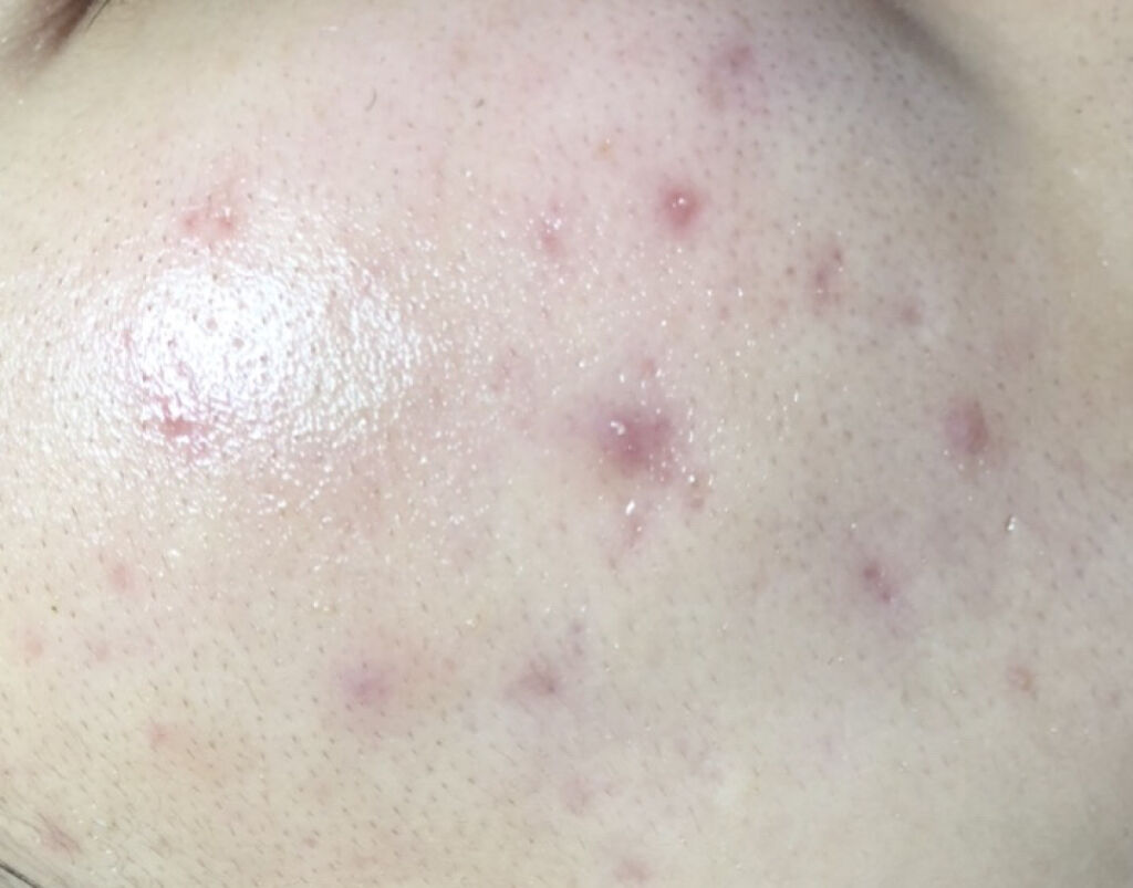 キールズ DS クリアリーブライト エッセンス[医薬部外品]/Kiehl's/美容液を使ったクチコミ（3枚目）