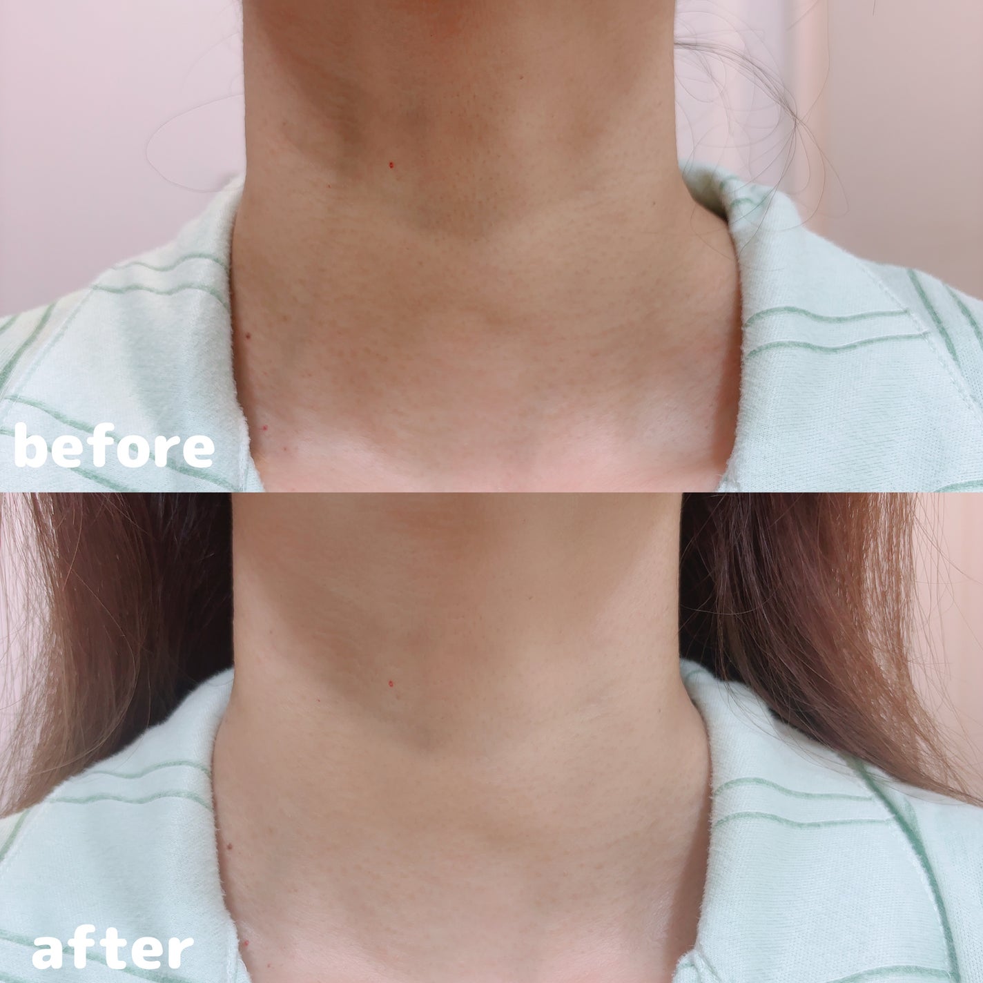 ベラ ネックパッチ/VELLA/シートマスク・パックを使ったクチコミ(3枚目)