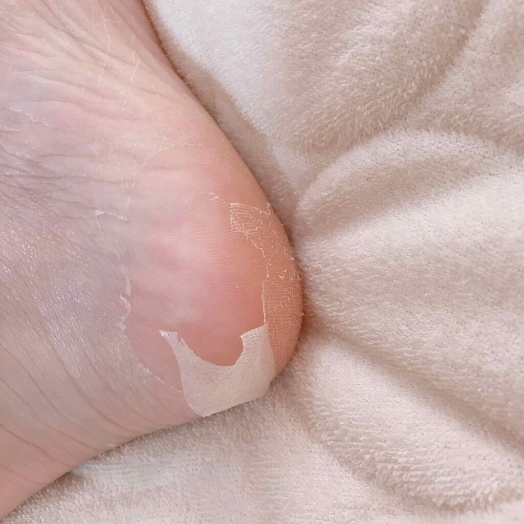 かかと どうスルん??そうスルんDX/Stay Free/レッグ・フットケアを使ったクチコミ(4枚目)