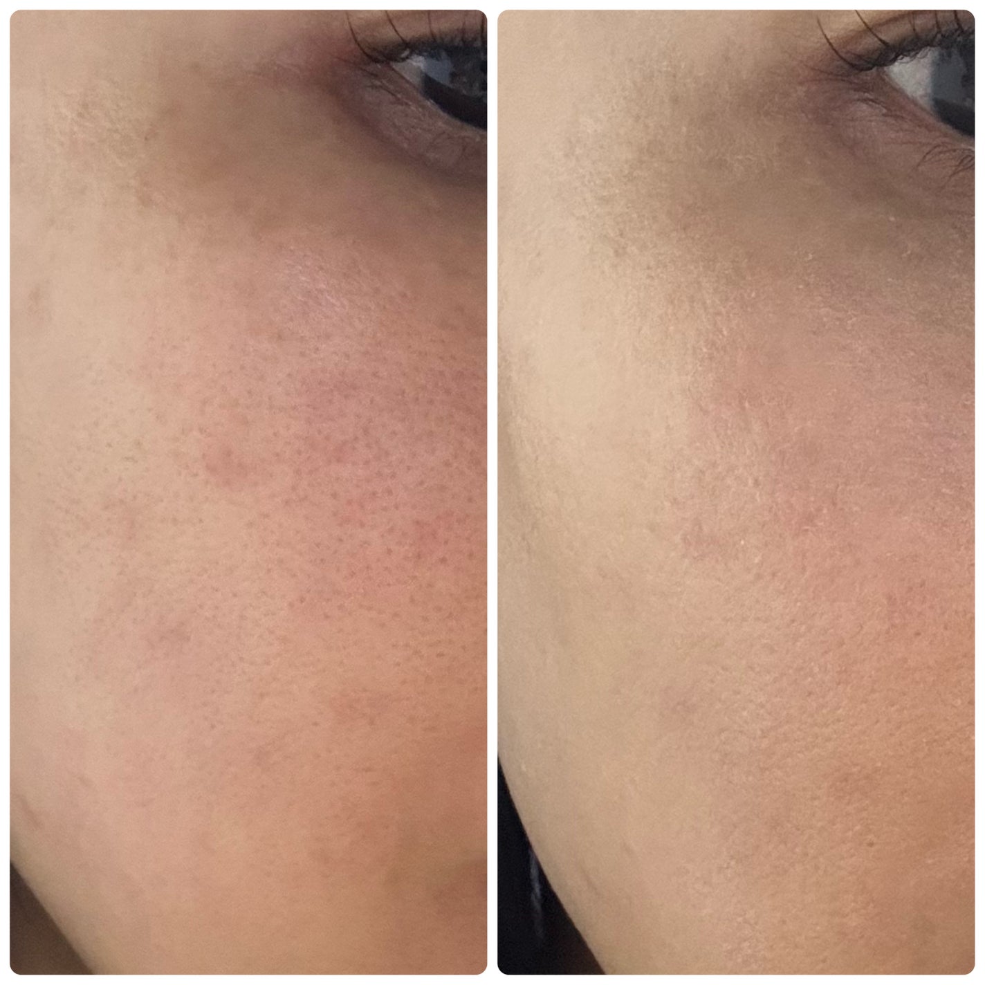 アイレノールすっぴんクリーム/IRENOL/クリームコンシーラーを使ったクチコミ(3枚目)