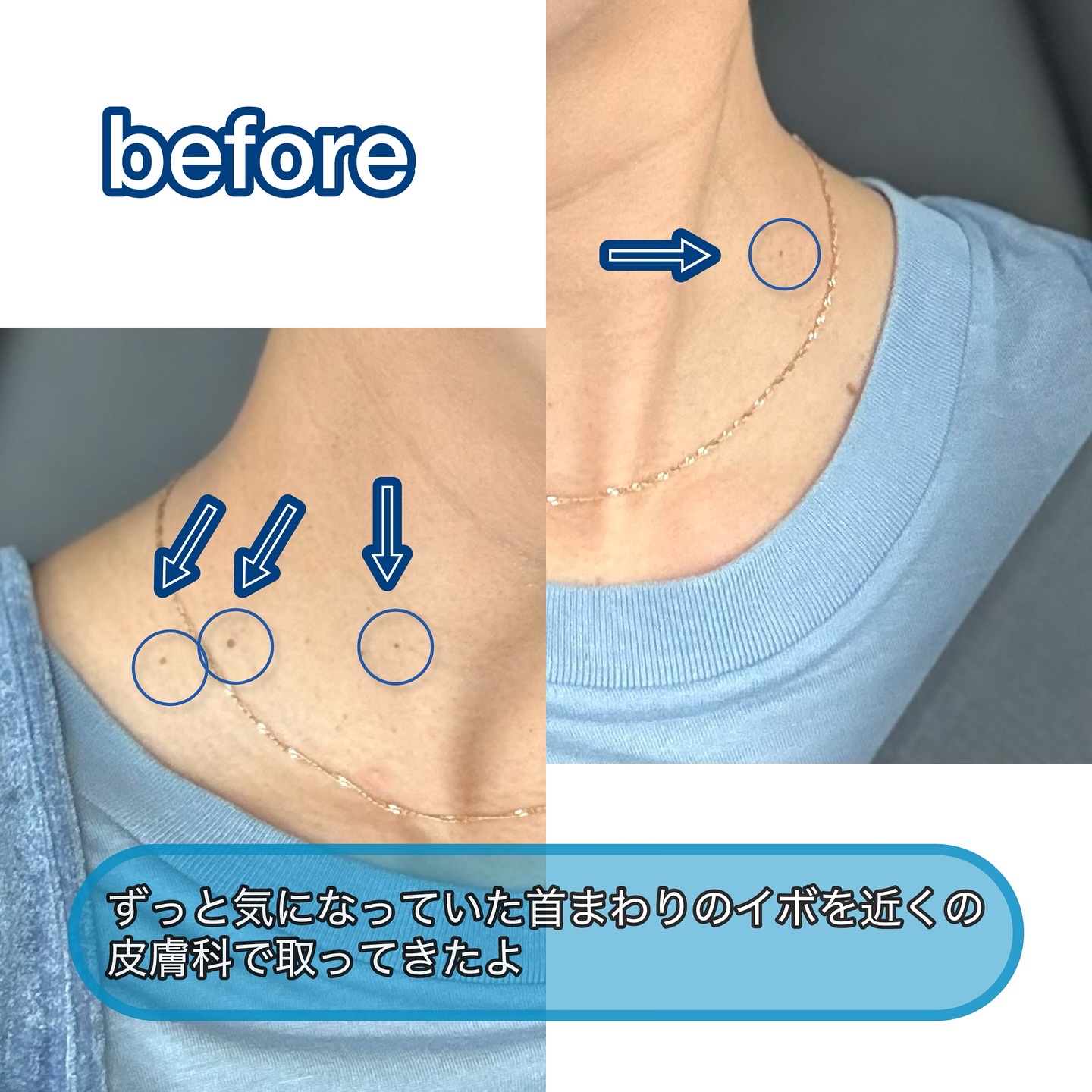 グラスティングカラーグロス/rom&nd/リップグロスを使ったクチコミ（2枚目）