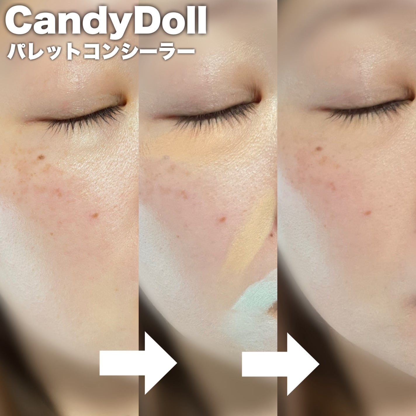 パレットコンシーラー/CandyDoll/パレットコンシーラーを使ったクチコミ(4枚目)