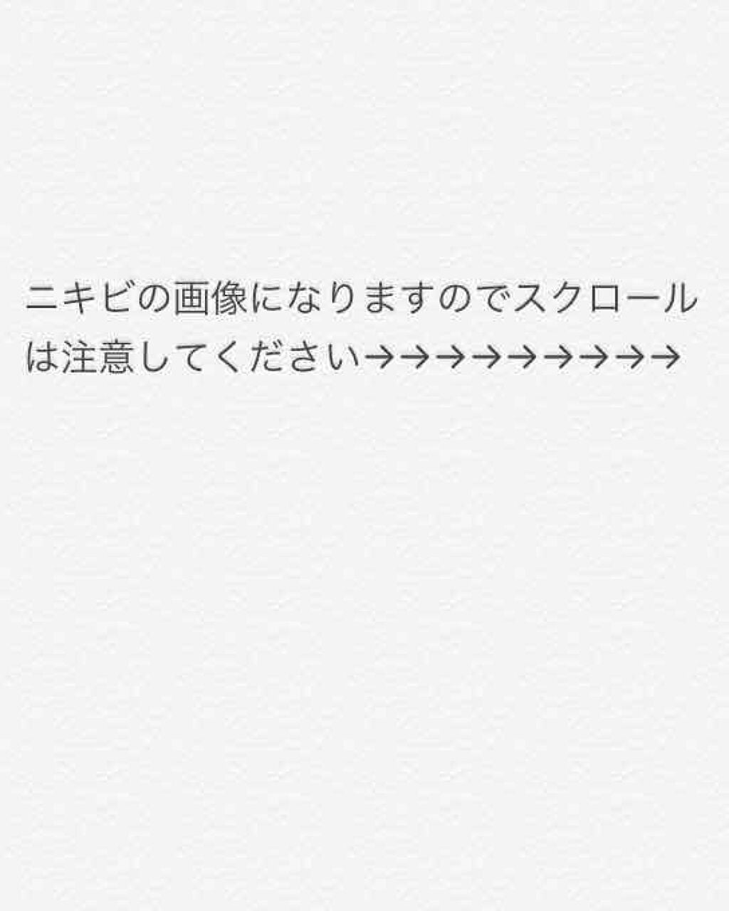 くもくも on LIPS 「9月末から夜勤の日以外は毎夜皮膚科で貰ったアダパレンとアクアチ..」(1枚目)