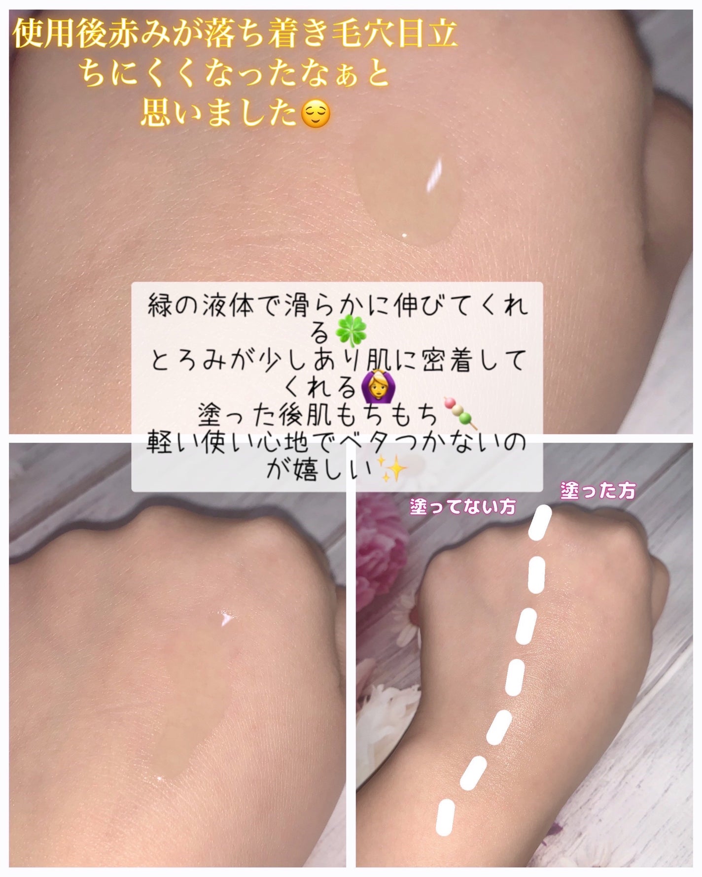 アゼライン酸15 インテンスカーミングセラム/Anua/美容液を使ったクチコミ(3枚目)