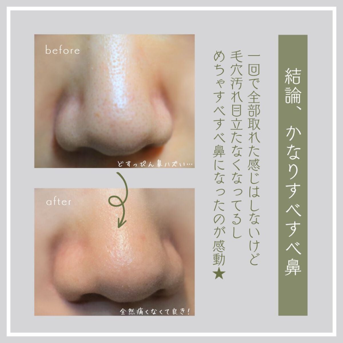 ブラックヘッドクリア2ステップノーズパッチ/DPU/シートマスク・パックを使ったクチコミ(5枚目)