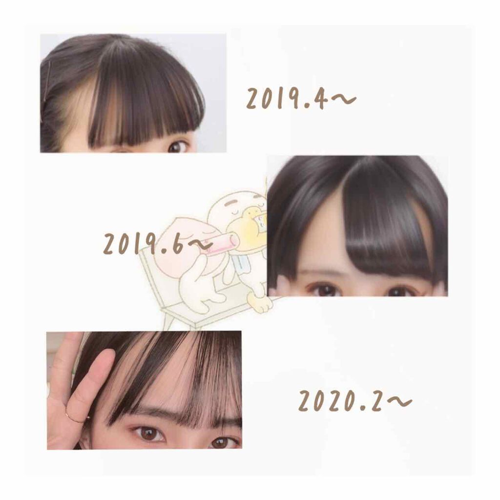 跡が付かない前髪クリップ/マペペ/ヘアアクセサリーを使ったクチコミ（2枚目）