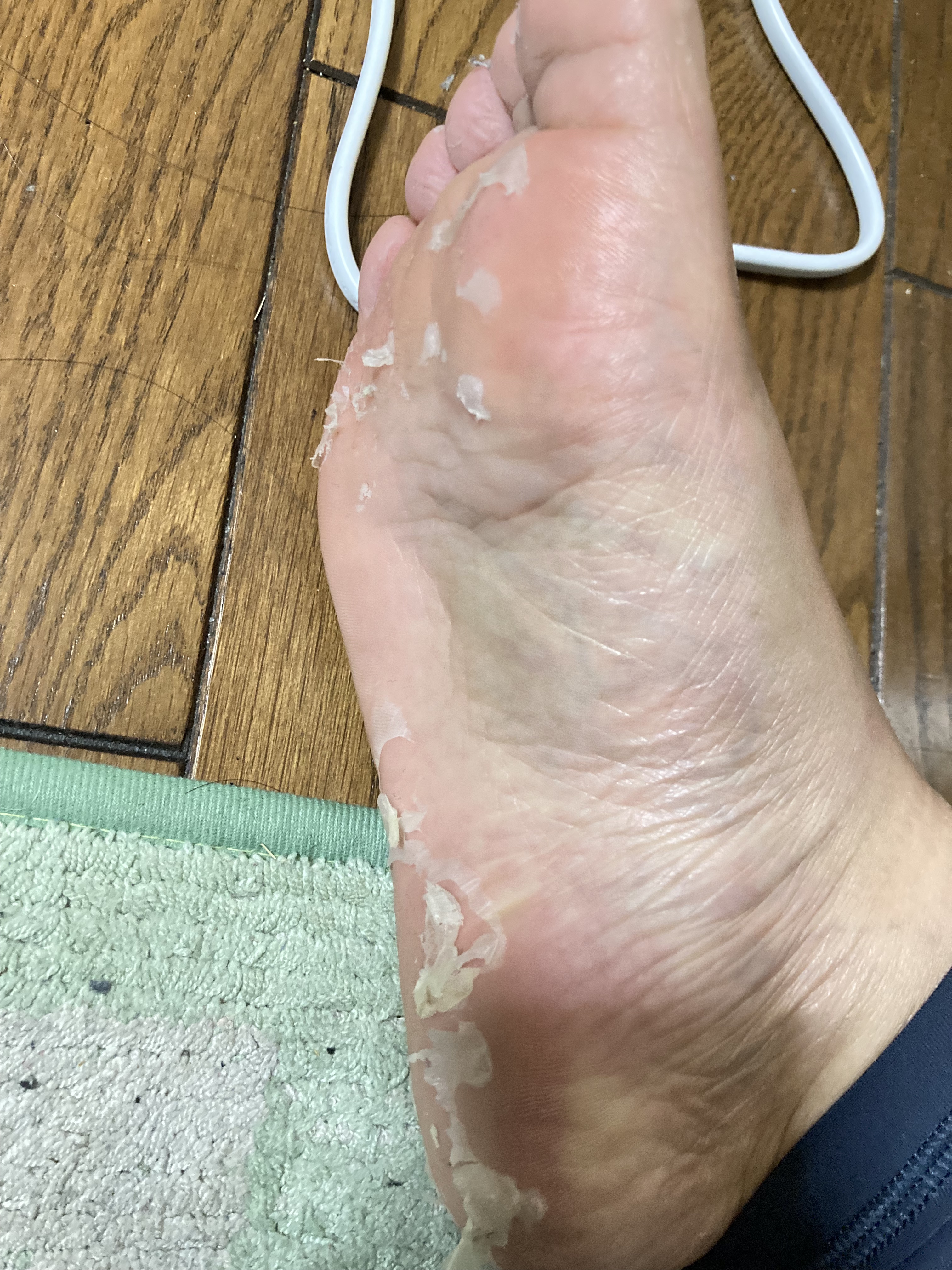 ふわふわマシュマロフット/リベルタ/レッグ・フットケアを使ったクチコミ（3枚目）