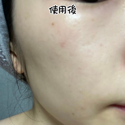 ザビタミンC23/IOPE/美容液を使ったクチコミ(5枚目)