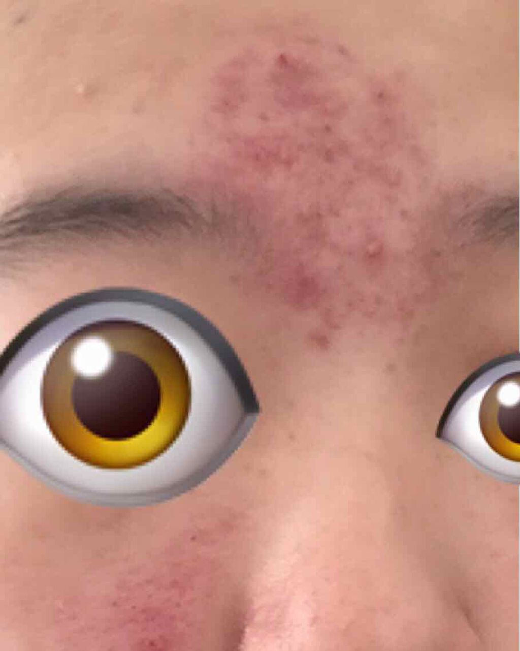 女の子になりたい on LIPS 「生理でさらに肌荒れがひどくなってしまいました、、、、2つもニキ..」(1枚目)