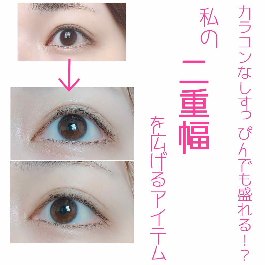 ふたえテープ 目立たず肌になじむ絆創膏タイプ/DAISO/二重まぶた用アイテムを使ったクチコミ（1枚目）