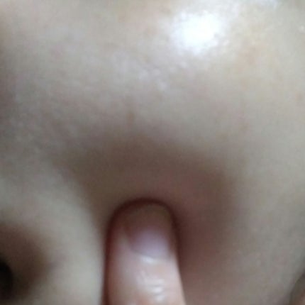 プロバイオダーム タイトニング コラーゲンセラム/BIOHEAL BOH/美容液を使ったクチコミ(3枚目)