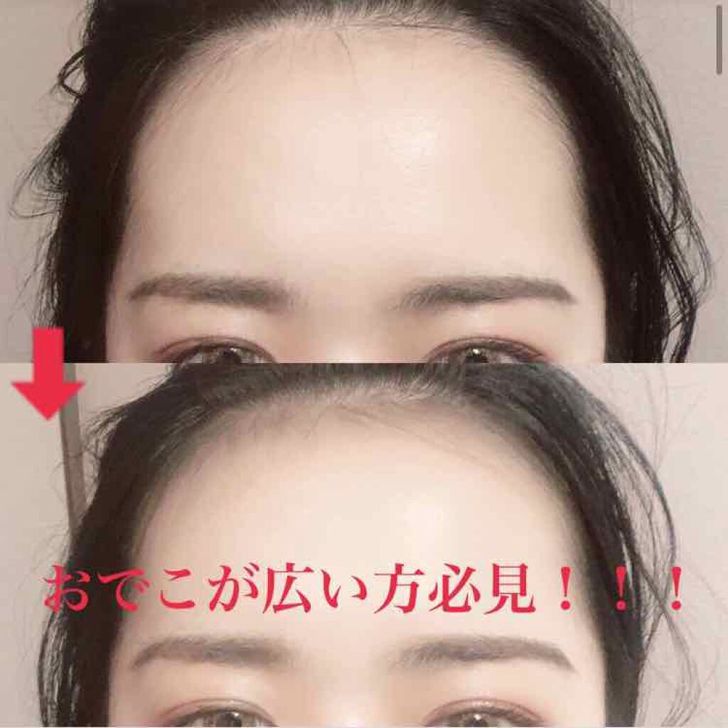 フジコdekoシャドウ Fujikoの口コミ 長年おでこが広すぎることに悩んでいて や By Momo 混合肌 代前半 Lips