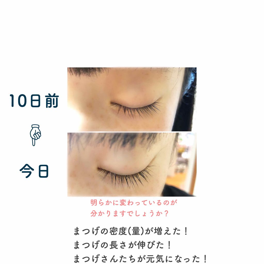 ローヤルゼリー配合 栄養ローション/DAISO/美容液を使ったクチコミ(2枚目)