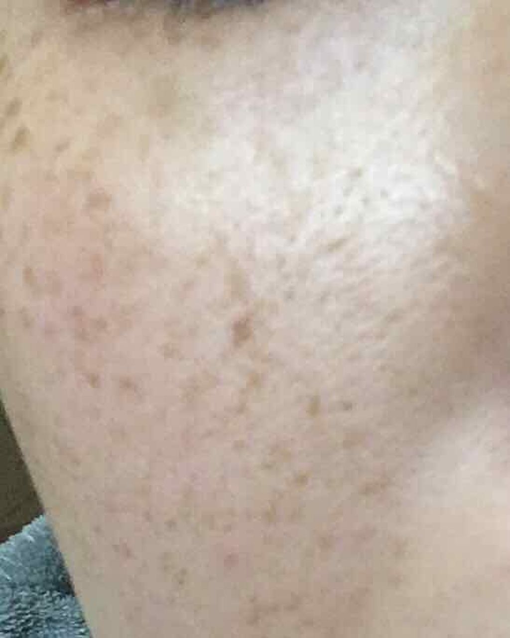 ねこ(´・ω・`) on LIPS 「度々質問をさせていただいているのですが…いいね!はありがたいの..」(1枚目)