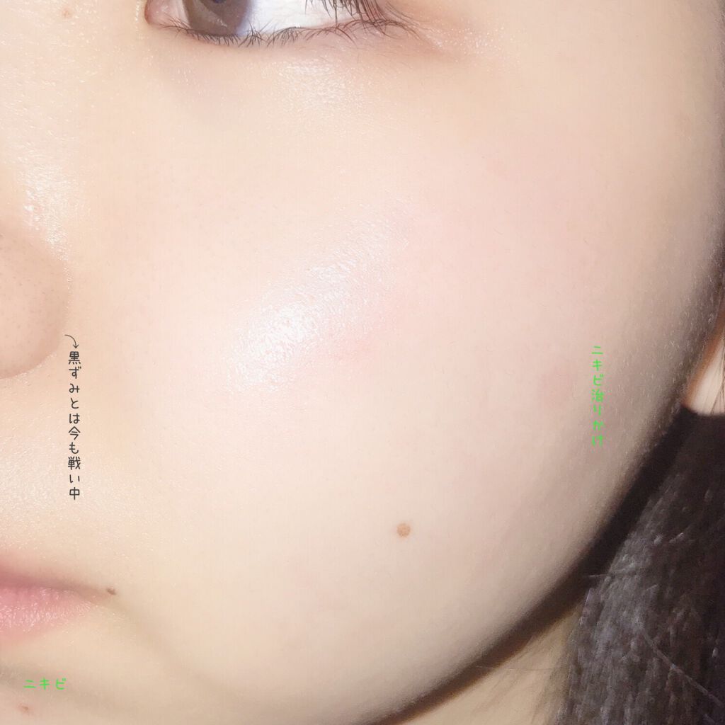 潤浸保湿 フェイスクリーム/キュレル/フェイスクリームを使ったクチコミ（3枚目）