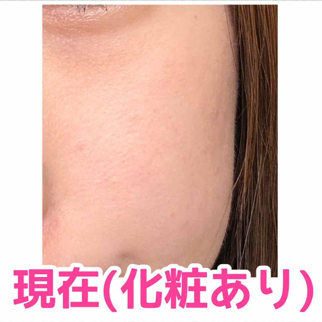 ハトムギ化粧水(ナチュリエ スキンコンディショナー R )/ナチュリエ/化粧水を使ったクチコミ（3枚目）