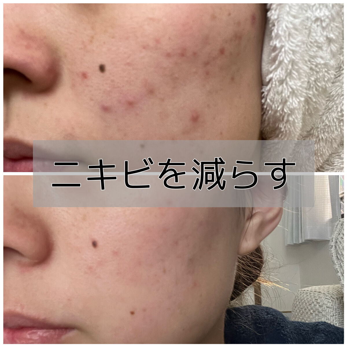 白潤プレミアム薬用浸透美白化粧水/肌ラボ/化粧水を使ったクチコミ（1枚目）