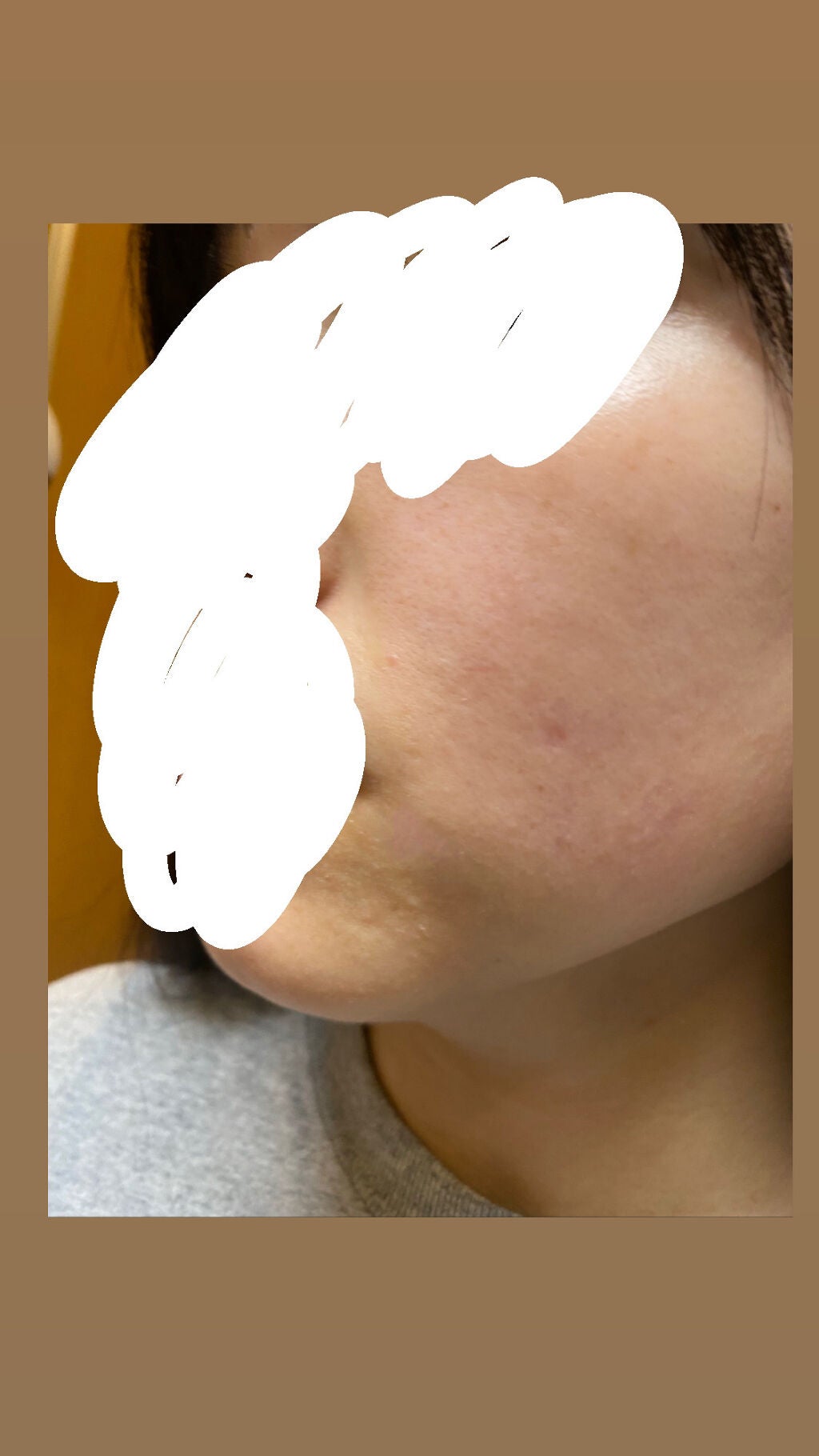 MkPopR1219 on LIPS 「どれかわからないけどめっちゃ肌荒れたklairs→・あったかく..」(2枚目)