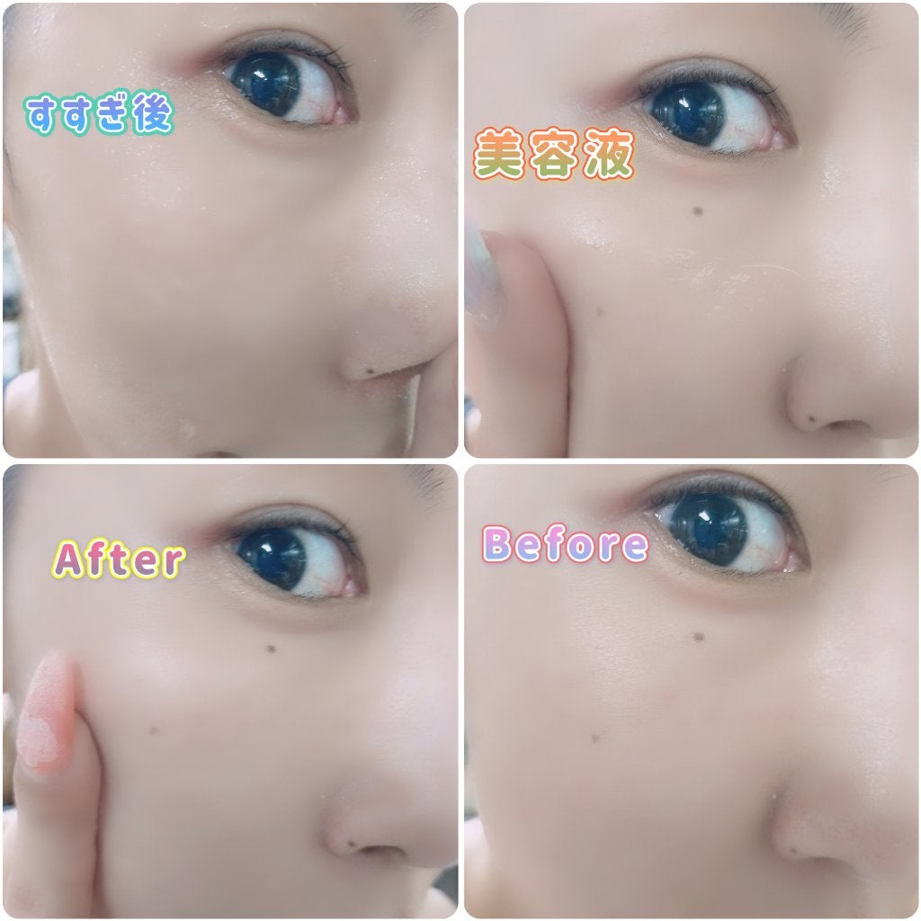 チョコブラ スペシャル毛穴ケアセット/Chocobra/スキンケアキットを使ったクチコミ(6枚目)