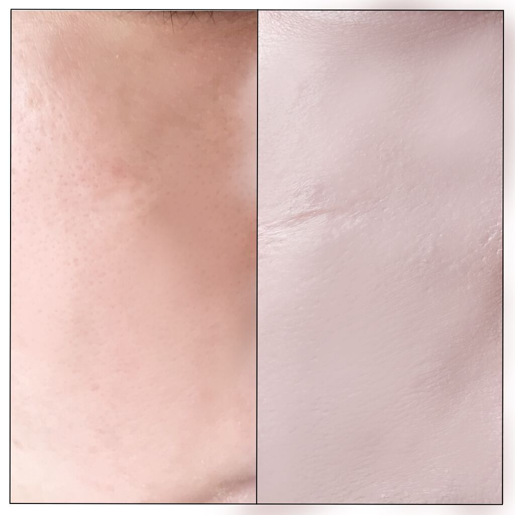 DEBEAUS バイオ インナー RX SRG クッション/DEBEAUS/クッションファンデーションを使ったクチコミ（3枚目）