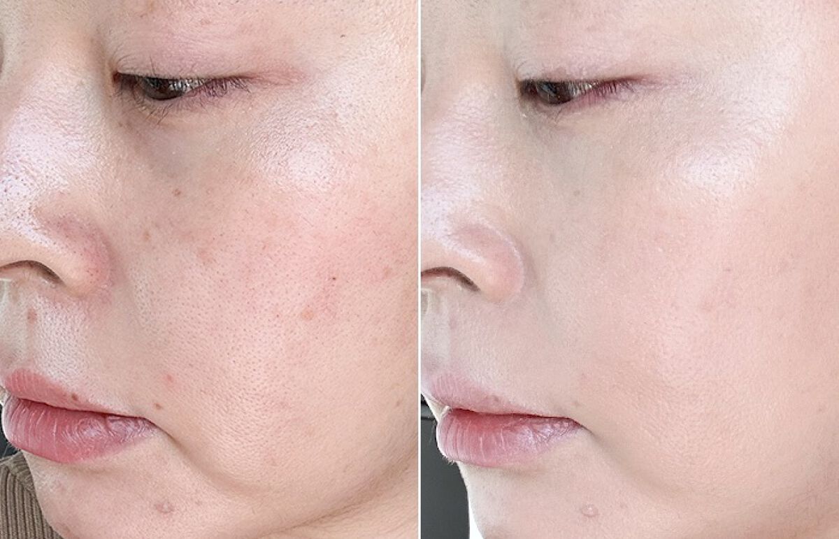 クラウド スキン グロー クッション XX01 ホンデ/HASH/クッションファンデーションを使ったクチコミ(3枚目)