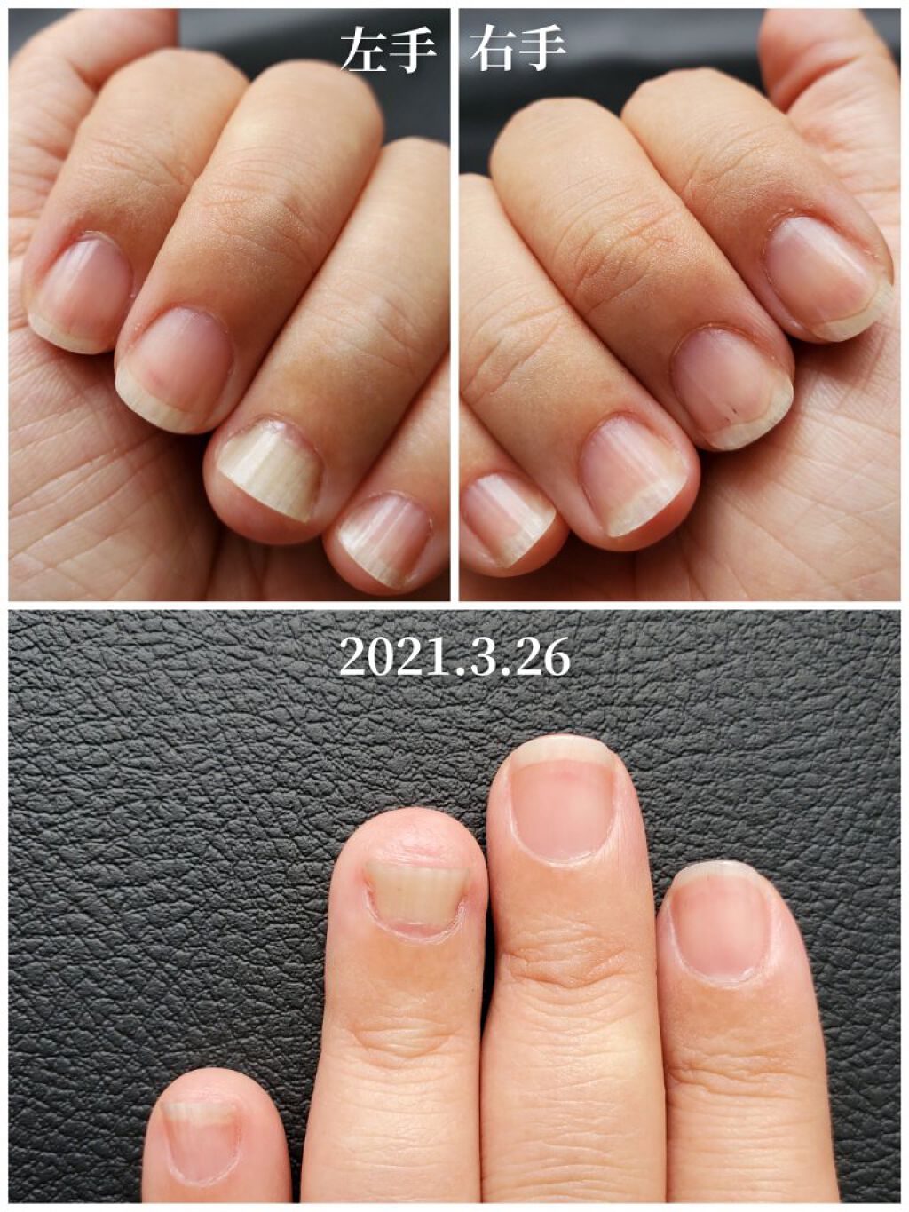 エテュセ クイックケアコート/ettusais/ネイルオイル・トリートメントを使ったクチコミ（2枚目）