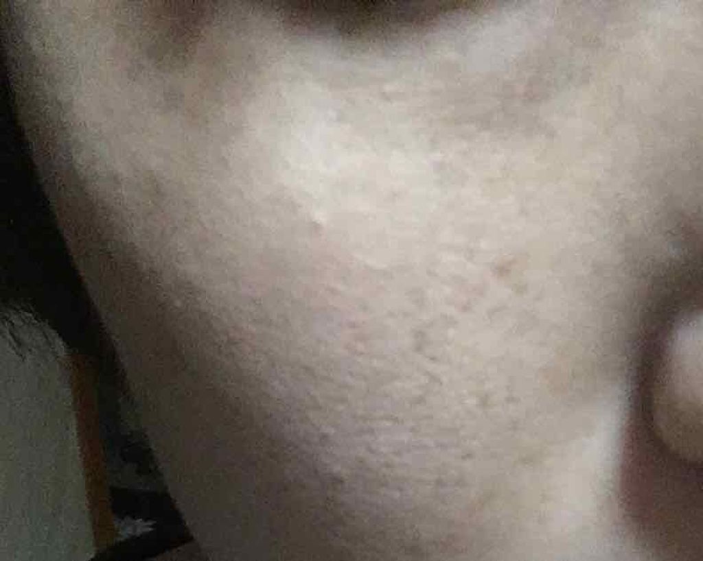 を使ったクチコミ（1枚目）