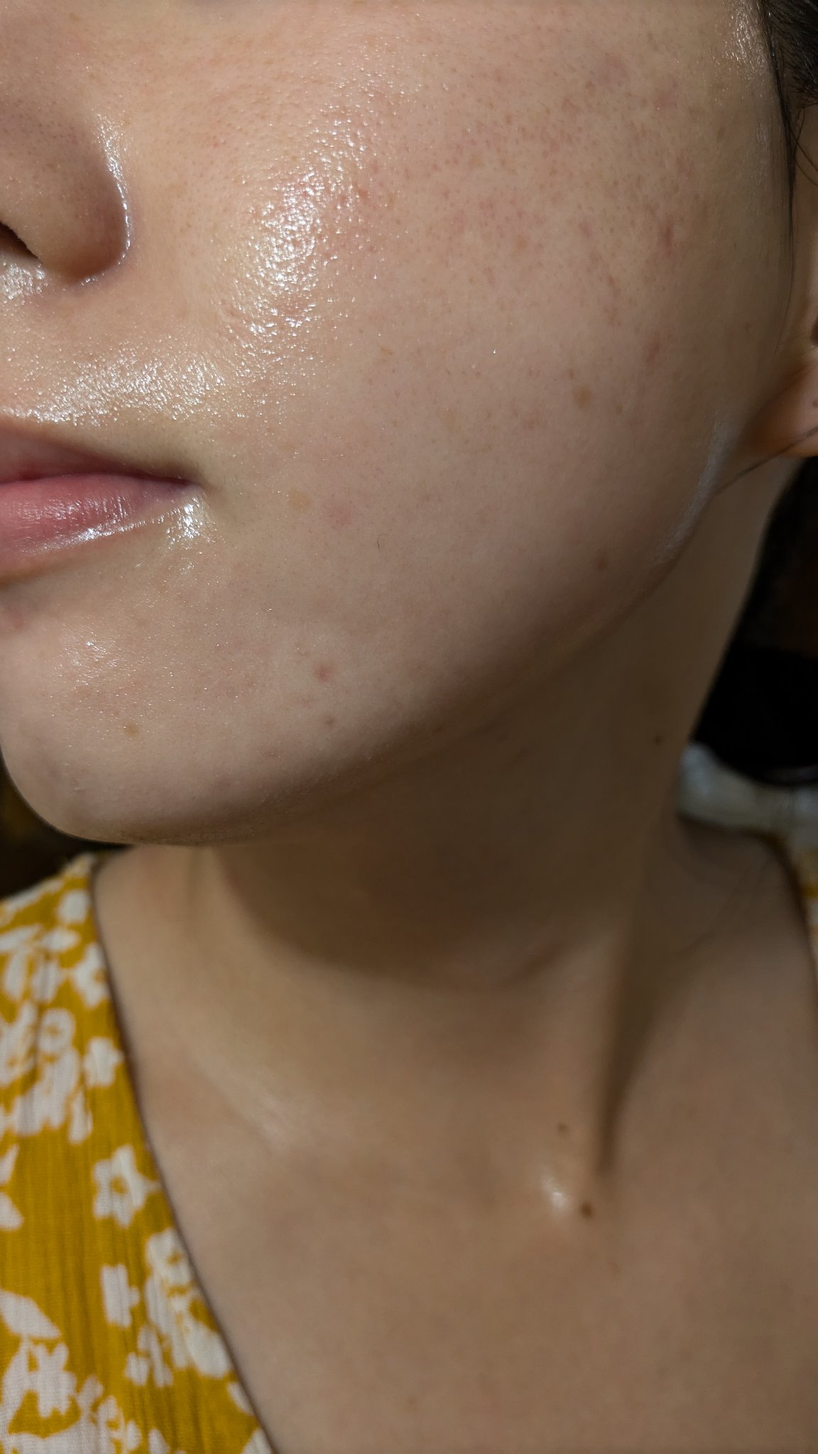 クリーム NC/なめらか本舗/フェイスクリームを使ったクチコミ（2枚目）