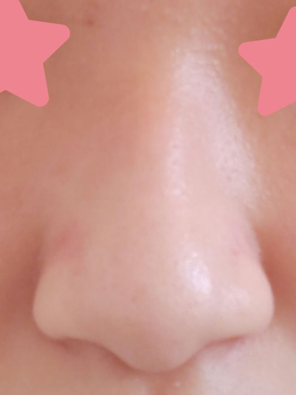 ノーズトレーナー/DAISO/その他スキンケアグッズを使ったクチコミ（3枚目）