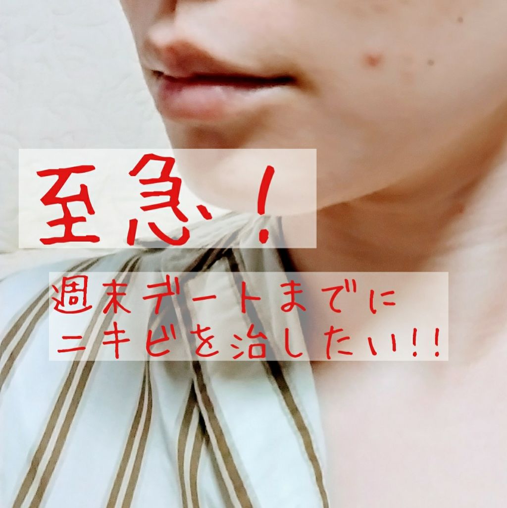 モイスチャー ミストローションII（しっとり）/アルージェ/ミスト状化粧水を使ったクチコミ（2枚目）