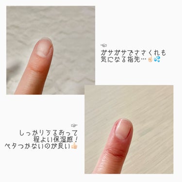 ▶︎シュガードール デュアルネイルセラム 7ml ¥1350


日々良いネイルオイルが無いかな～と模索している白桃です🍑


使用前によく振ってから使います。


ネイルセラムやネイルオイルは塗った直後は保湿されて良いのですが、ベタついてスマホを触ったり作業をしたりができないのが気になっていました🤔


こちらの商品は、しっかり保湿が続くのに、すぐにサラサラ～✨になる不思議な感覚！

ハケで手軽に塗れるのもポイント高いです🙆‍♀️


これ一本で補修＆保湿が可能！

【補修】傷んだ爪表面をコーティング補修し、なめらかに整えます。
【保湿】オイルの美容液が、爪にうるおいを与え、乾燥を防ぎます。


ネイルセラムをお探しの方、オススメです✨


#ネイルオイル #ネイルセラム #シュガーネイル #爪_ケア  #LIPS投稿アワードメイクハウツー の画像 その2