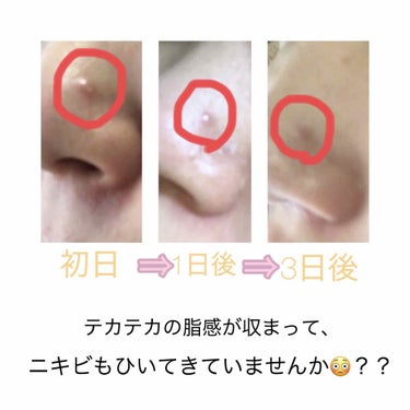 薬用クリーム洗顔/メンソレータム アクネス/洗顔フォームを使ったクチコミ（3枚目）