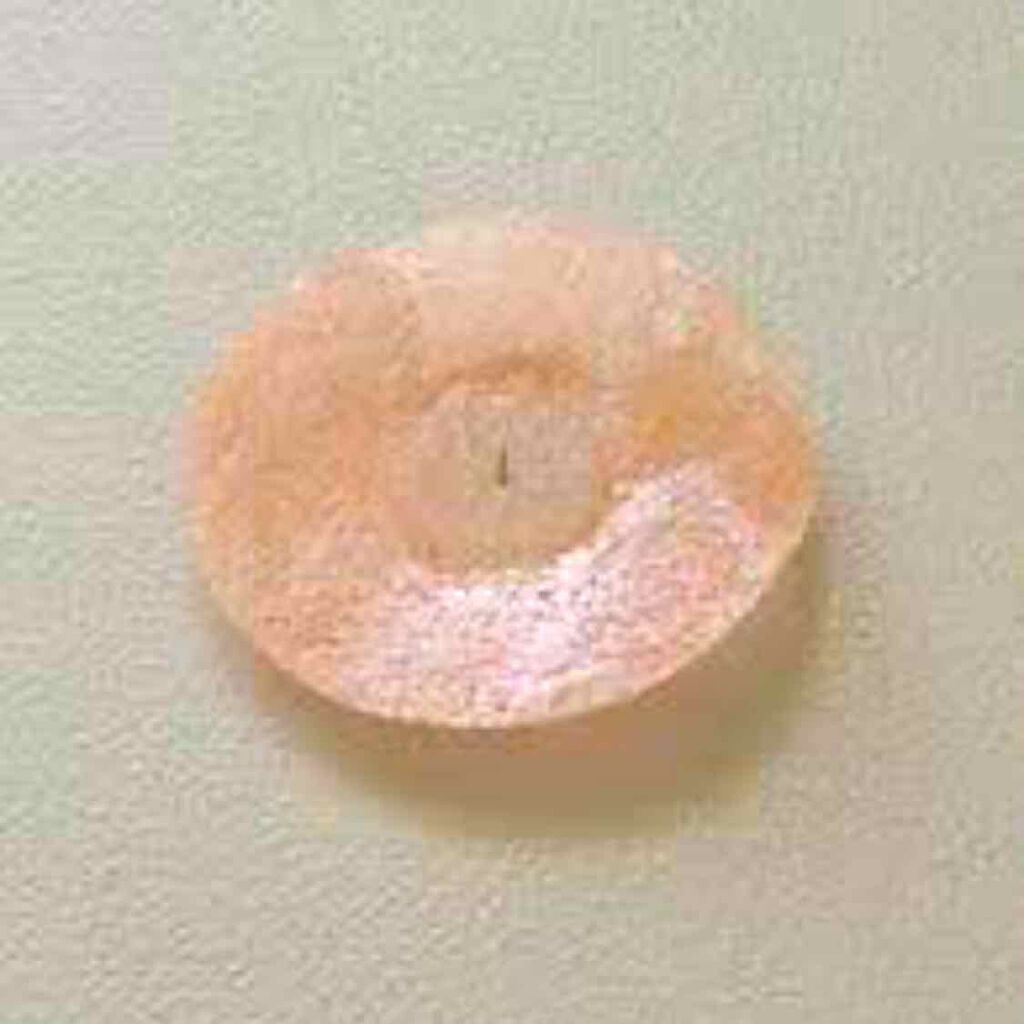 円皮鍼/セイリン/その他を使ったクチコミ(2枚目)