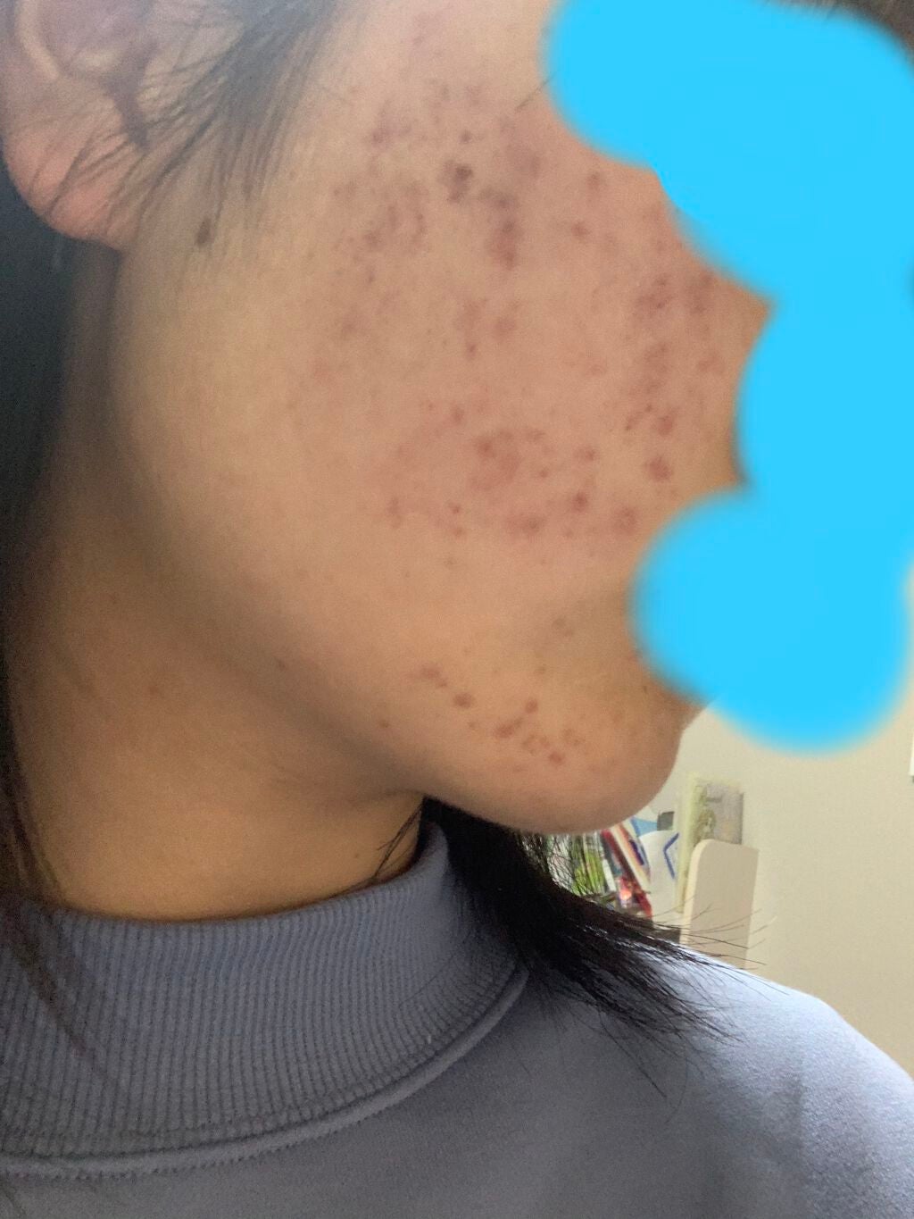 樽紅 on LIPS 「皆さん!とりまのスキンケアPart3!!今日は2月……28……..」(3枚目)