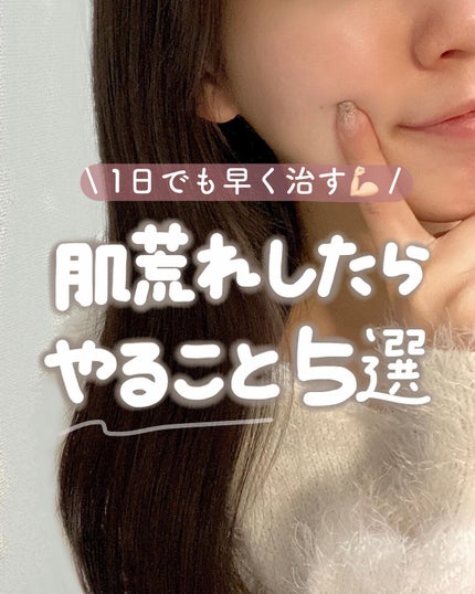 保湿浸透水モイストリッチ/肌をうるおす保湿スキンケア/化粧水を使ったクチコミ(1枚目)