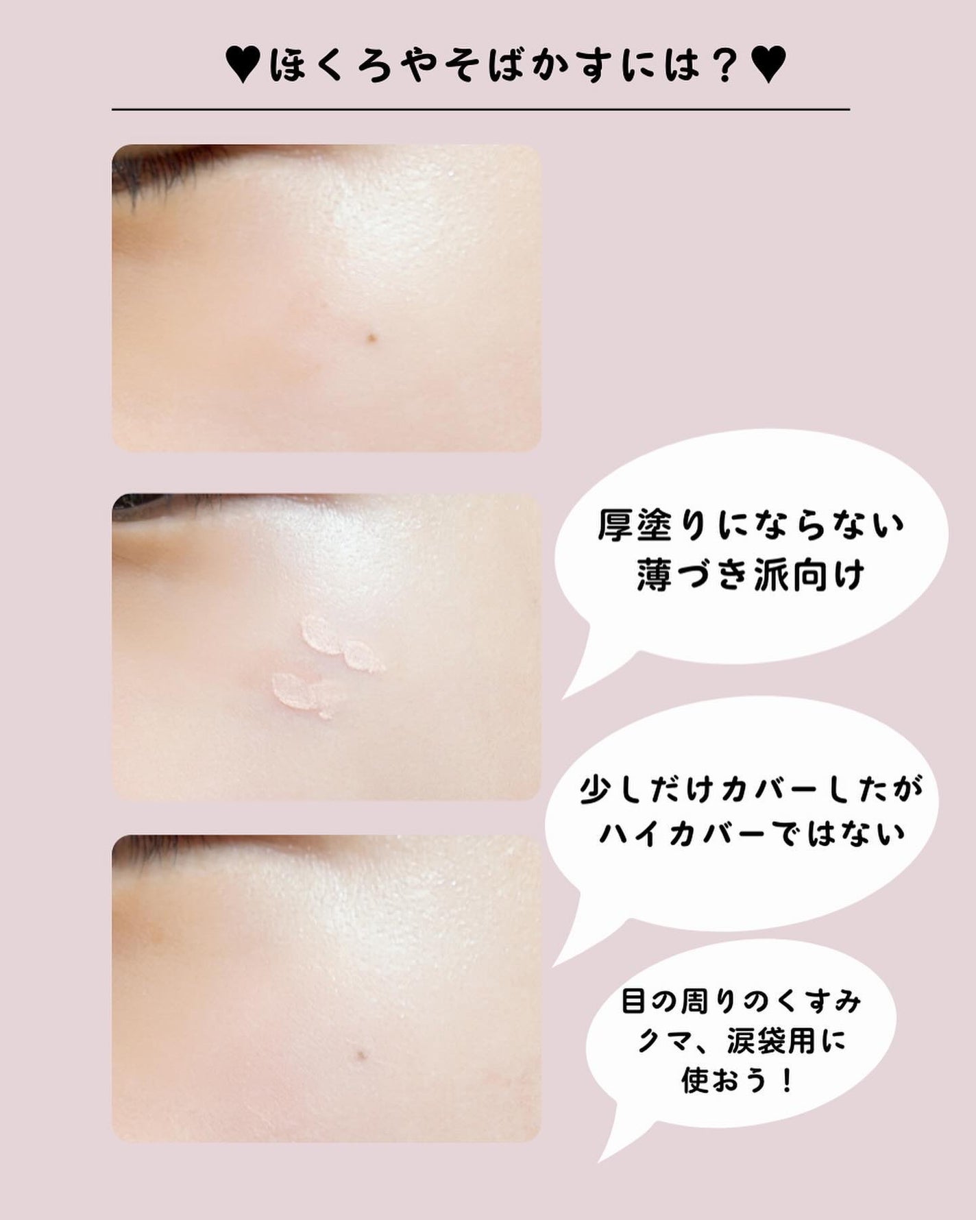 デイジードール コンシーラー パレット/DAISY DOLL by MARY QUANT/パレットコンシーラーを使ったクチコミ(5枚目)