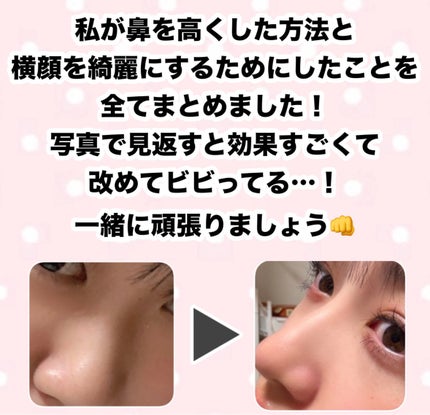 ハトムギ保湿ジェル(ナチュリエ スキンコンディショニングジェル)/ナチュリエ/美容液を使ったクチコミ(1枚目)