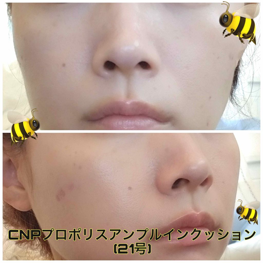 プロポリスアンプルインクッション/CNP Laboratory/クッションファンデーションを使ったクチコミ（3枚目）