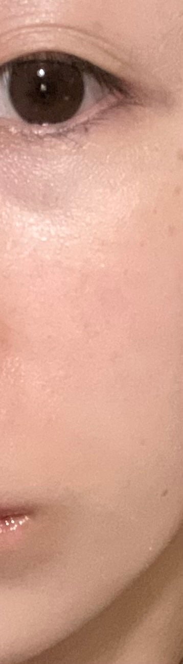 ããã³ ã¢ããã¢ã€ã¹ã ãšã€ãžã³ã°ã±ã¢ ãã€ã¯ãªãŒã UV/ããã³/æ¥çŒãæ¢ãã¯ãªãŒã ã䜿ã£ãã¯ãã³ãïŒ3æç®ïŒ