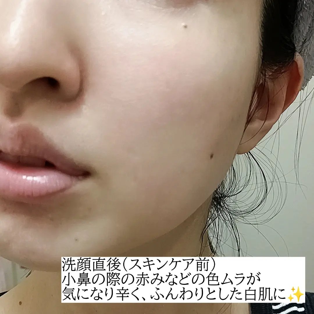 TX-アンプルクレンザー/Dr.Melaxin/美容液を使ったクチコミ（3枚目）